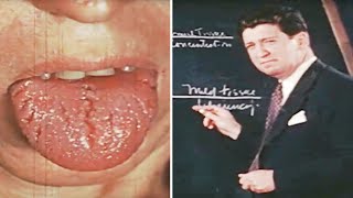 1944 The Impact of Vitamin Deficiencies – Scurvy Pellagra Beriberi amp More Explained [upl. by Elkcim]