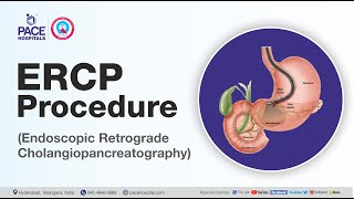 What is ERCP Test and How it is done  Department of Gastroenterology  Pace Hospitals [upl. by Carroll725]