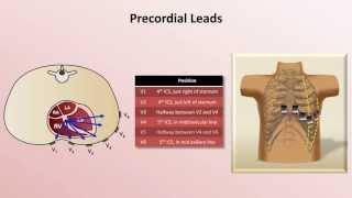 Intro to EKG Interpretation  EKG Leads [upl. by Townshend]