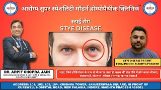 Stye Disease Patient Treated by Dr Arpit Chopra Jain [upl. by Harday797]