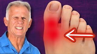 BIG Toe Pain RELIEF amp Walk Normal Again Hallux Rigidus [upl. by Cinemod]