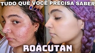 COMO É TOMAR ROACUTAN antes e depois efeitos colaterais dicas evolução e contraindicações ✨️ [upl. by Fatimah]