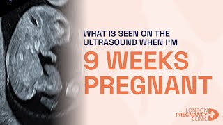 Week 9 of Pregnancy Ultrasound Brain Heart amp Gender Development [upl. by Kinzer]