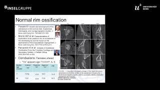 Acetabular rim fractures demographics and unanswered therapeutic questions  Michael Millis Se 1 [upl. by Amalea490]