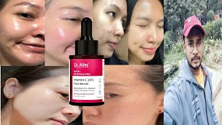 Dr alies vitamin c 15 face serum  honest review [upl. by Handler]