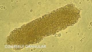 Análisis de Sedimentos en Orina UPRRCM Tecnología Médica 2016 [upl. by Holsworth]