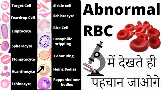 RBC Anomalies  RBC Abnormal Morphology  Inclusion bodies under microscope 🔬 [upl. by Ardnuahs]