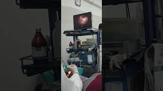 Nasal Endoscopy  ENT  FIND OUT TREATMENT  endoscopy ent nose sinusitis dnd youtubeshorts [upl. by Roede]