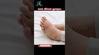 how to reduce swelling in legs  swelling in legs home remedies  how to treat edema naturally [upl. by Aseefan]