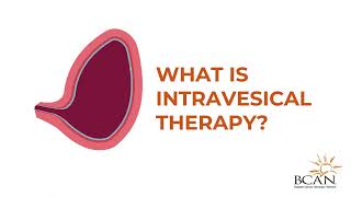 What is Intravesical Therapy  Bladder Cancer Advocacy Network [upl. by Mercuri199]