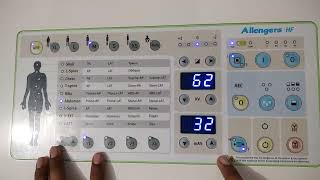 Allengers  Fuji FCR combination Allengers control panel part 2 xray room setup [upl. by Rozalin]