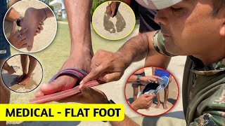 SSC GD MEDICAL TEST FLAT FOOT🦶को कैसे सही करे  घर में इलाज कैसे करे  फ्लैट फुट क्या है MEDICAL [upl. by Eillit]