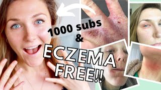 ECZEMA Cured How I Healed My Eczema Naturally  5 Eczema Healing Stages  Project Reverse complete [upl. by Ikkim]