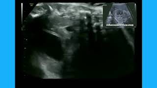 Ob Gyn Sonography [upl. by Kudva879]