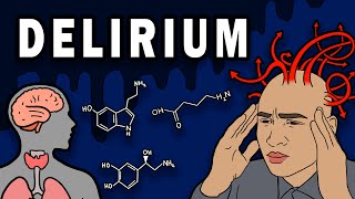 DELIRIUM  Causes Symptoms Physiology [upl. by Ber336]