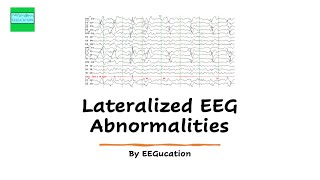 Lateralized EEG Abnormalities [upl. by Marcellus]