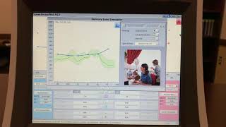 Simulation of hearing loss [upl. by Son]