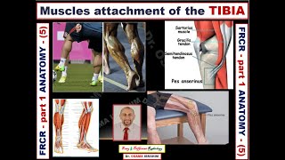 FRCR part 1 Anatomy 5 tibia [upl. by Ainoek]