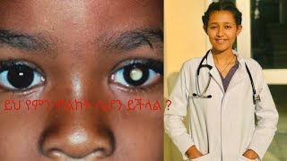 ረቲኖብላስቶማ retinoblastoma የአይን ካንሰር [upl. by Airdnahs]