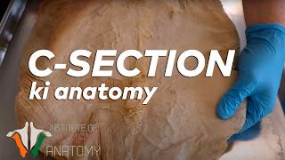 CSection ki Anatomy in Hindi [upl. by Letrice521]