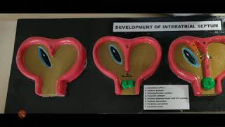 Development of interatrial septum exam model important [upl. by Sioux]