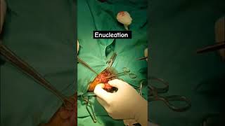 Enucleation of eyeball surgeryproptosisveterinarianjourneyvetjunctiondogdogloverenucleation [upl. by Figone]