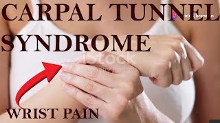 Carpal Tunnel Syndrome CAUSING Your Wrist PAIN [upl. by Terena495]