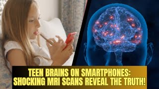 Teen Brains on Smartphones Shocking MRI Scans Reveal the Truth  Most Viral Today [upl. by Ettedo]