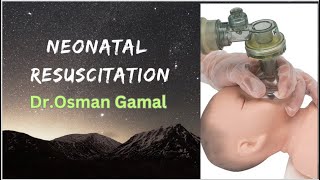 Neonatal Resuscitation  for NICU physicians [upl. by Enyak519]