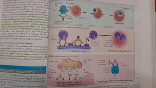 Type 2 Hypersensitivity Reaction  GENERAL PATHOLOGY [upl. by Khano]