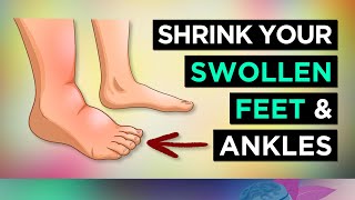 6 Ways To SHRINK Your SWOLLEN FEET amp ANKLES Remedies [upl. by Rust]