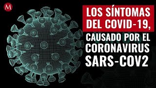 Los síntomas del covid19 causado por el coronavirus SARSCoV2 [upl. by Llet]