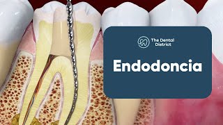 Salva un Diente de ser Extraído con una Endodoncia  The Dental District [upl. by Aihsenat]