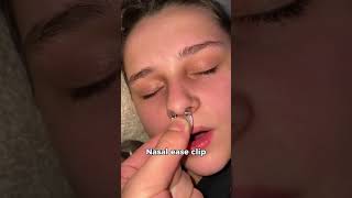 Instantly stops snoring🤯🤯 mouthbreathing snoringhusband snoring snoreclips sleepapnea [upl. by Ralph]