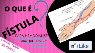 FÍSTULA PARA HEMODIÁLISE O QUE É  PARA QUE SERVE [upl. by Vullo869]