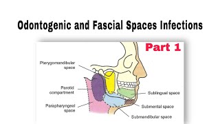 Odontogenic and Fascial Spaces Infections طب الأسنان مرحلة رابعة oralsurgery [upl. by Hedwig]