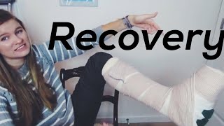 Bunion Surgery Recovery Process [upl. by Adnovay]