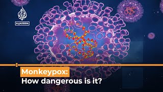 Monkeypox virus outbreak What’s happening [upl. by Handy]