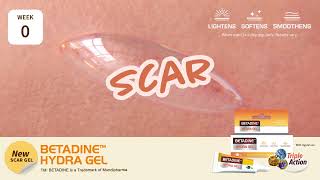 New BETADINE HYDRA GEL [upl. by Frendel]