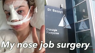 OPERACJA NOSA W KLINICE DR SZCZYTA💉 🙊 NOSE JOB IN POLAND [upl. by Reeta698]