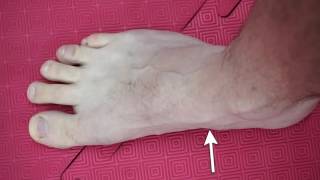 Foot Intrinsic Muscles Activation [upl. by Anawat]