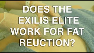 Does the Exilis Elite work for fat reduction  The Body Clinic  Exilis Elite Fat Reduction FAQ 🎯 [upl. by Aracaj891]