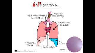 Pathophysiology and Management [upl. by Calderon]