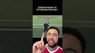 Ederson Injury Footage RELEASED 😵‼️ how can the premier league allow this [upl. by Siroled]