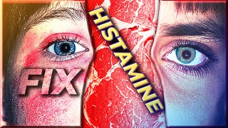 How I fixed my Histamine Intolerance [upl. by Rosenfeld97]