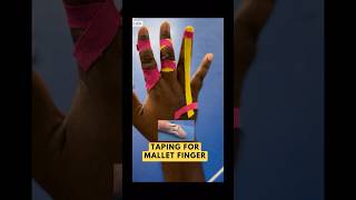 3 ways of Taping for Mallet finger shorts [upl. by Grover]