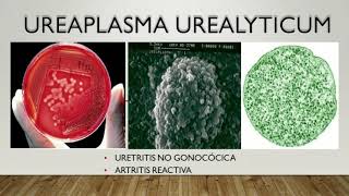 Ureaplasma Enfermedades Transmisibles [upl. by Melquist]