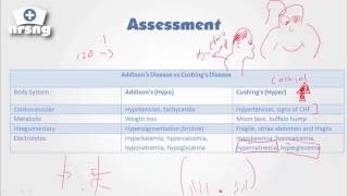 Cushings Syndrome NCLEX® Review  NRSNGacademycom [upl. by Schulze]