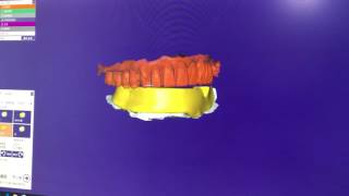 Exocad Design of complete denture baseplate [upl. by Calmas]