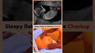 Midwife Checkup 😍 Baby Boy Ultrasound in the Womb pregnancy fetus subscribe [upl. by Atalayah]